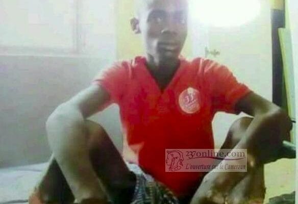 Affaire Ibrahim Moussa: Le jeune homme a été amputé à l’Hôpital central de Yaoundé