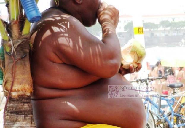 Cameroun – Obésité : La maladie de la mauvaise hygiène de vie