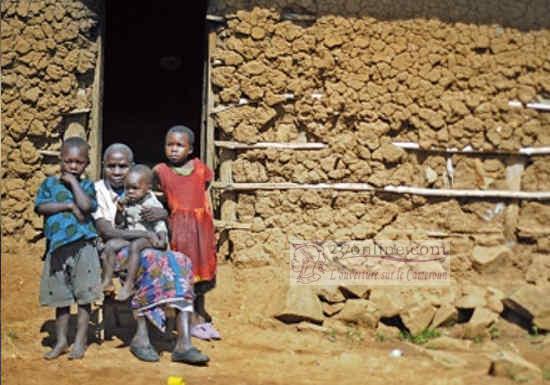 Cameroun – Abdoul Karim: « Je vis de la mendicité depuis 33 ans »