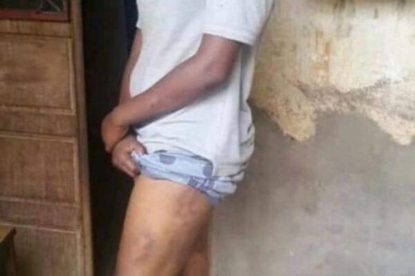 Cameroun : Une militante du MRC raconte les tortures subies au SED