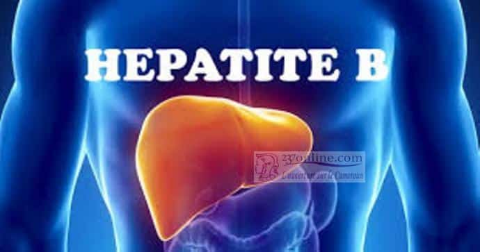 Hepatite B