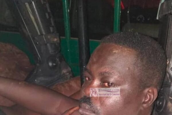 Cameroun: Traitement Cruel et barbare du 1er Vice-président du Mrc