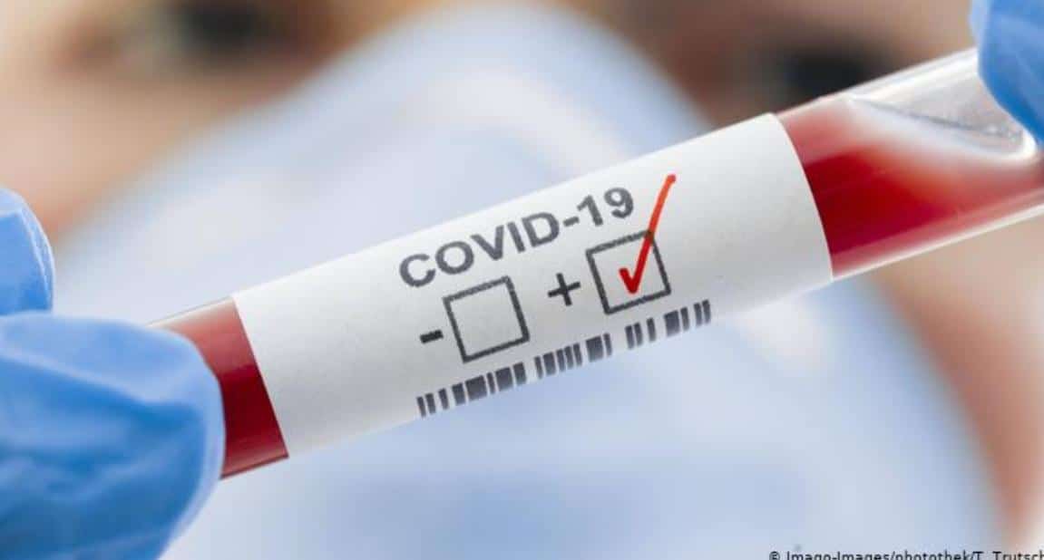 covid-19 test