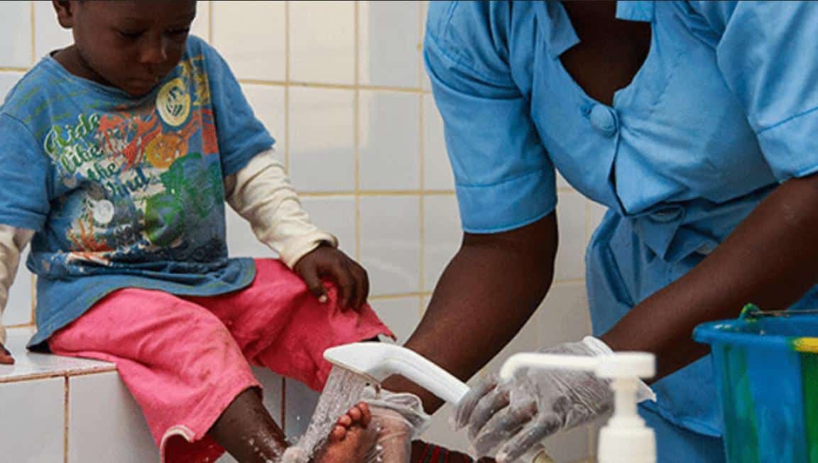 Cameroun : Les maladies tropicales négligées ne sont pas une malédiction
