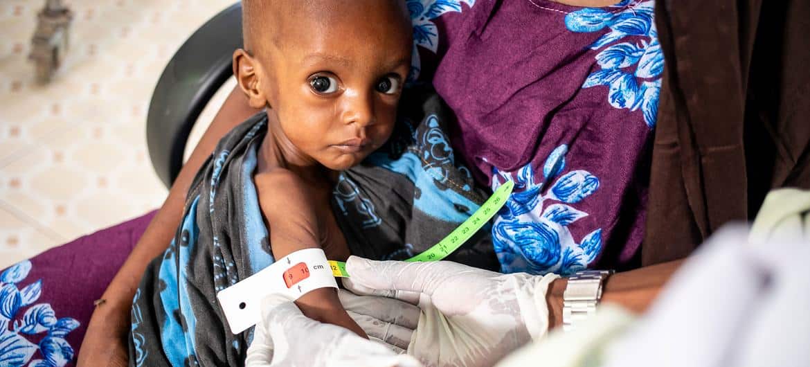 global hunger crisis pushing one child per minute into severe malnutrition