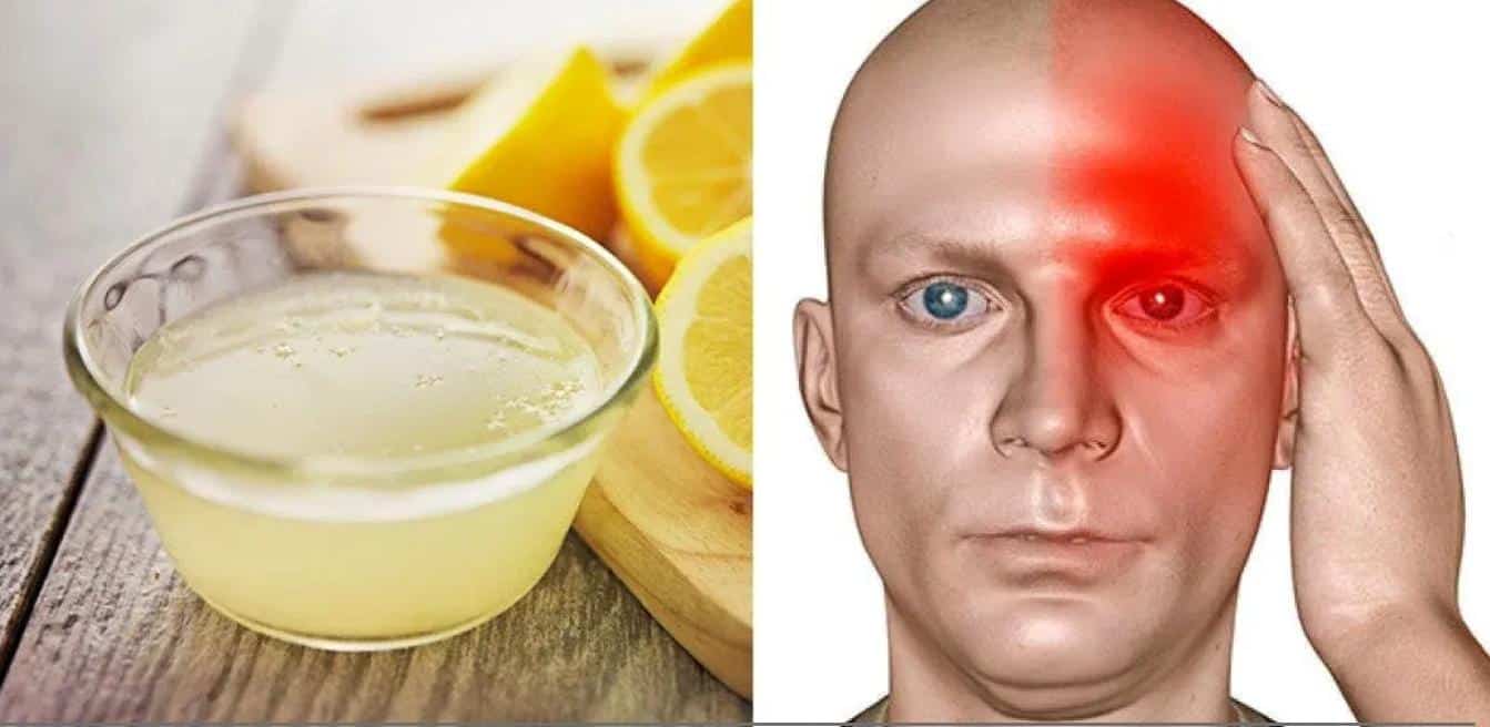 Maux de tête: Voici comment se soigner avec un citron