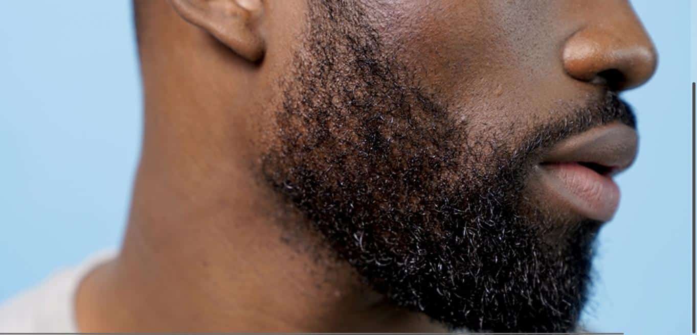 La barbe est bonne pour la santé car elle nous protège des rayons UV nocifs