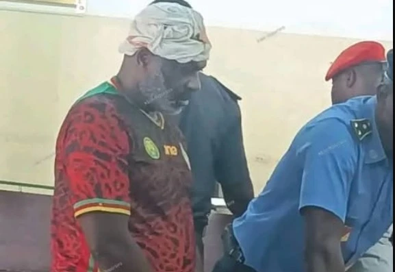 Cameroun Nwafo Dagobert : Tabassé durant 48h par les détenus de Kondengui