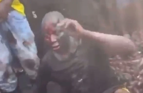 Douala : Scandale à New Bell après un vol d’organe génital ! [EXCLUSIF]